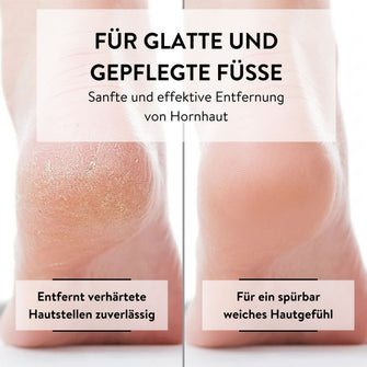 PARSA Beauty Pedi ID Duo Hornhautfeile für samtweiche Füße & sanfte Pflege