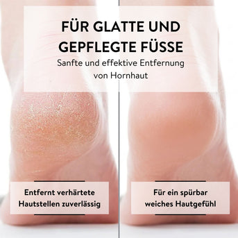 PARSA Beauty Pedi ID Duo Hornhautfeile für samtweiche Füße & sanfte Pflege
