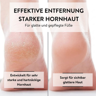PARSA Beauty PEDI ID Hornhauthobel Ersatzklingen Pediküre Set