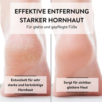 PARSA Beauty PEDI ID Hornhauthobel Ersatzklingen Pediküre Set