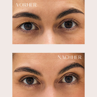 PARSA Beauty LIFESTYLE Anti-Schlupflid-Tapes – optischer Lifting-Effekt